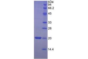SDS-PAGE analysis of Human MYL2 Protein. (MYL2 Protein)