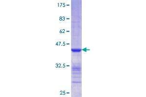 CLIC5 Protein (AA 91-190) (GST tag)
