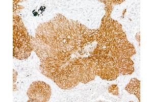 anti-Desmoglein 3 (DSG3) antibody