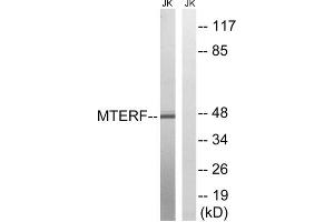 Western blot analysis of extracts from Jurkat cells, using MTERF antibody.