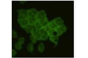 Immunocytochemistry (ICC) image for anti-B-cell antigen receptor complex-associated protein alpha chain (CD79A) antibody (ABIN1854863) (CD79a antibody)