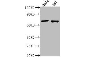Western Blot Positive WB detected in: Hela whole cell lysate, U87 whole cell lysate All lanes: USP17L1 antibody at 1:2000 Secondary Goat polyclonal to rabbit IgG at 1/50000 dilution Predicted band size: 60 kDa Observed band size: 60 kDa (USP17L1 antibody  (C-Term))