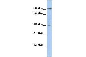 PYGB antibody used at 1 ug/ml to detect target protein. (PYGB antibody  (N-Term))
