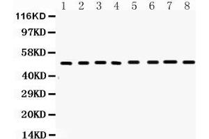 Western blot analysis of FAS expression in mouse liver extract ( Lane 1), mouse spleen extract ( Lane 2), mouse brain extract ( Lane 3) mouse kidney extract ( Lane 4), mouse thymus extract ( Lane 5), mouse lung extract ( Lane 6), HEPA1-6 whole cell lysates ( Lane 7) and NIH3T3 whole cell lysates ( Lane 8). (FAS antibody  (N-Term))