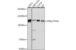 Western blot analysis of extracts of various cell lines, using PRK2/PRK2/PKN2 Rabbit mAb (ABIN7269646) at 1:1000 dilution. (PKN2 antibody)