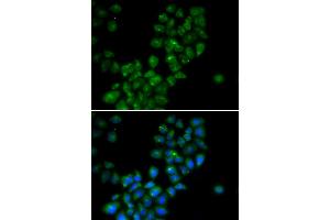 Immunofluorescence analysis of HeLa cells using CANT1 antibody (ABIN5973753). (CANT1 antibody)