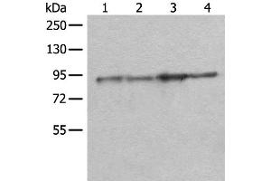 Western blot analysis of Rat brain tissue Mouse brain tissue A549 and PC-3 cell lysates using DDX1 Polyclonal Antibody at dilution of 1:300 (DDX1 antibody)