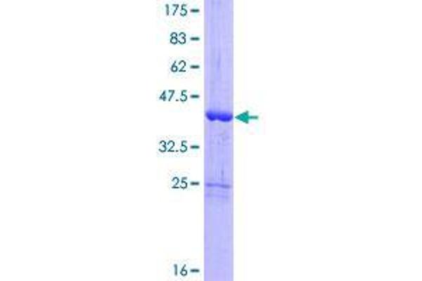 GLRX5 Protein (AA 1-157) (GST tag)