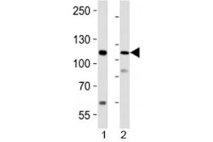 Western blot analysis of lysate from 1) human LNCaP cell line and 2) mouse lung tissue using PRDM16 antibody at 1:1000.