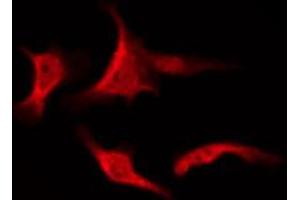 ABIN6267613 staining NIH-3T3 by IF/ICC.