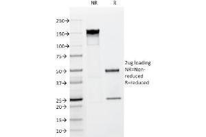 SDS-PAGE Analysis Purified FGF23 Mouse Monoclonal antibody (FGF23/638). (FGF23 antibody)