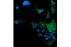 Image no. 2 for anti-Cancer/testis Antigen 1B (CTAG1B) antibody (ABIN1499900) (CTAG1B antibody)