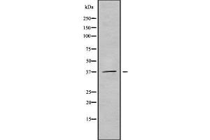 Western blot analysis of B3GALT6 using HuvEc whole cell lysates (B3GALT6 antibody  (Internal Region))