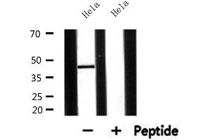 Western blot analysis of extracts from Hela, using AGPAT5 Antibody. (AGPAT5 antibody  (Internal Region))
