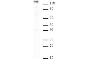PARP-1 C-terminal antibody tested by Western blot. (PARP1 antibody  (C-Term))