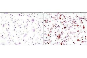 Immunohistochemistry (IHC) image for anti-Green Fluorescent Protein (GFP) antibody (ABIN1843725) (GFP antibody)