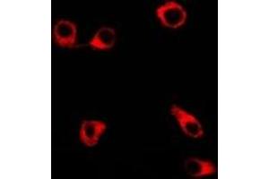 Immunofluorescent analysis of Clusterin staining in SW480 cells. (Clusterin antibody)