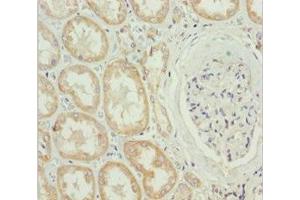 Immunohistochemistry of paraffin-embedded human kidney tissue using ABIN7159567 at dilution of 1:100 (MTX2 antibody  (AA 1-263))