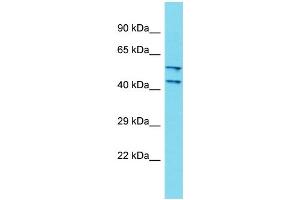 Host: Rabbit Target Name: DCAF4L2 Sample Type: Fetal Kidney lysates Antibody Dilution: 1. (DCAF4L2 antibody  (N-Term))