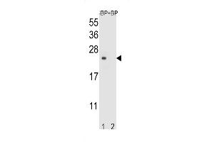 Western blot analysis of T4S4 Antibody (N-term) Pab (ABIN653705 and ABIN2843022) pre-incubated without(lane 1) and with(lane 2) blocking peptide in liver cell line lysate. (TM4SF4 antibody  (N-Term))