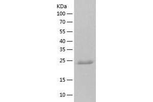 Western Blotting (WB) image for Nudix (Nucleoside Diphosphate Linked Moiety X)-Type Motif 16-Like 1 (NUDT16L1) (AA 1-211) protein (His tag) (ABIN7124241)