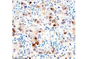 IHC analysis of Hsc70 using anti-Hsc70 antibody (ABIN7601962). (Hsc70 antibody  (AA 520-614))