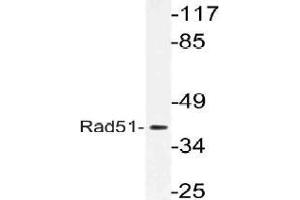 Western blot (WB) analysis of Rad51 antibody in extracts from 3T3 cells. (RAD51 antibody)