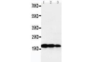 Anti-TNF beta antibody, Western blotting Lane 1: Recombinant Human TNF beta Protein 10ng Lane 2: Recombinant Human TNF beta Protein 5ng Lane 3: Recombinant Human TNF beta Protein 2.
