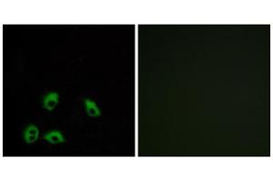 Immunofluorescence analysis of MCF-7 cells, using GPR103 antibody.