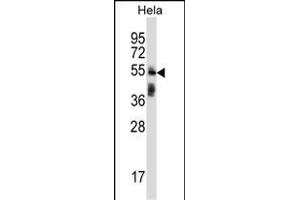 TRIM38 Antibody (C-term) (ABIN657328 and ABIN2846398) western blot analysis in Hela cell line lysates (35 μg/lane). (TRIM38 antibody  (C-Term))