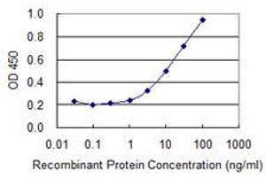 Detection limit for recombinant GST tagged ATP6V1B1 is 0. (ATP6V1B1 antibody  (AA 1-75))