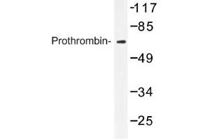 Image no. 1 for anti-Coagulation Factor II (thrombin) (F2) antibody (ABIN317606) (Prothrombin antibody)