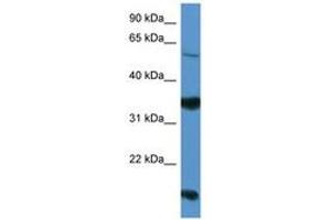 Image no. 1 for anti-Netrin G2 (NTNG2) (AA 199-248) antibody (ABIN6746812)