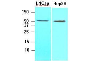 Western Blotting (WB) image for anti-Acyl-CoA Thioesterase 11 (ACOT11) (AA 19-250) antibody (ABIN317516) (ACOT11 antibody  (AA 19-250))