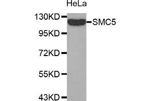 Western Blotting (WB) image for anti-Structural Maintenance of Chromosomes 5 (SMC5) antibody (ABIN1874872) (SMC5 antibody)