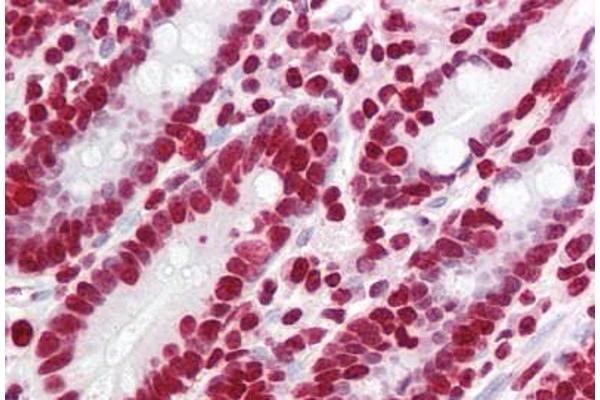 YPEL5 antibody  (N-Term)