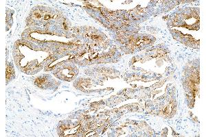 anti-Tight Junction Protein 1 (TJP1) (AA 650-700) antibody