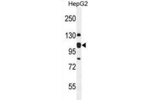 Western Blotting (WB) image for anti-KIAA0090 (KIAA0090) antibody (ABIN2995572)