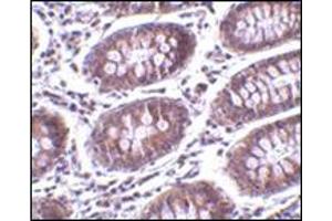 Immunohistochemistry of MICA in human colon tissue with this product at 10 μg/ml. (MICA antibody  (C-Term))