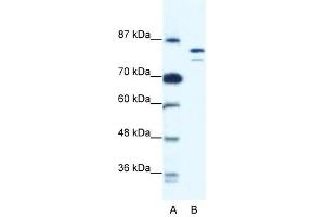 MCM8 antibody used at 0. (MCM8 antibody  (N-Term))