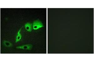 Immunofluorescence analysis of HepG2 cells, using Calmodulin (Ab-79/81) Antibody. (Calmodulin 1 antibody  (AA 46-95))