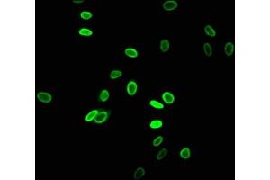 Immunofluorescent analysis of Hela cells using ABIN7139183 at dilution of 1:100 and Alexa Fluor 488-congugated AffiniPure Goat Anti-Rabbit IgG(H+L) (HIST1H2AG antibody  (acLys5))