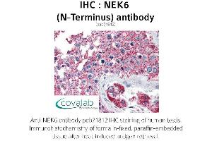 Image no. 2 for anti-NIMA (Never in Mitosis Gene A)-Related Kinase 6 (NEK6) (N-Term) antibody (ABIN1737252)