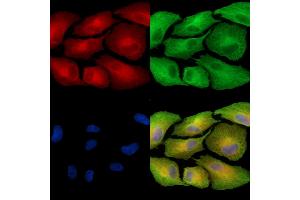 ABIN7096955 and ABIN7101022 staining  cells by IF/ICC.