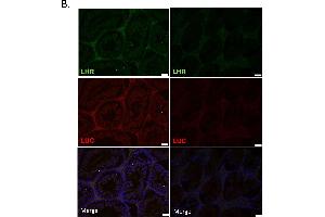 Immunofluorescence (Paraffin-embedded Sections) (IF (p)) image for anti-Luteinizing Hormone/Choriogonadotropin Receptor (LHCGR) (C-Term) antibody (ABIN2857013)