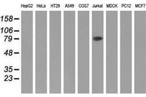 Western blot analysis of extracts (35 µg) from 9 different cell lines by using anti-ALDH1L1 monoclonal antibody. (ALDH1L1 antibody)
