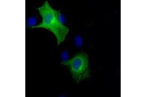 Image no. 6 for anti-B-Raf proto-oncogene, serine/threonine kinase (BRAF) antibody (ABIN1496952) (BRAF antibody)