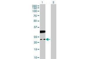 Lane 1: NAP1L5 transfected lysate ( 19. (NAP1L5 293T Cell Transient Overexpression Lysate(Denatured))