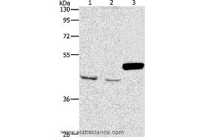 Western blot analysis of A172 and K562 cell, mouse pancreas tissue, using ARMCX3 Polyclonal Antibody at dilution of 1:900 (ARMCX3 antibody)