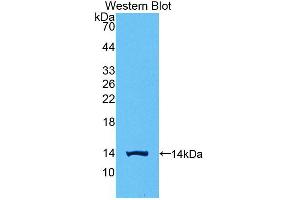 Western blot analysis of the recombinant protein. (CGB antibody  (AA 55-153))